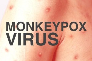 Apa itu Virus Cacar Monyet?